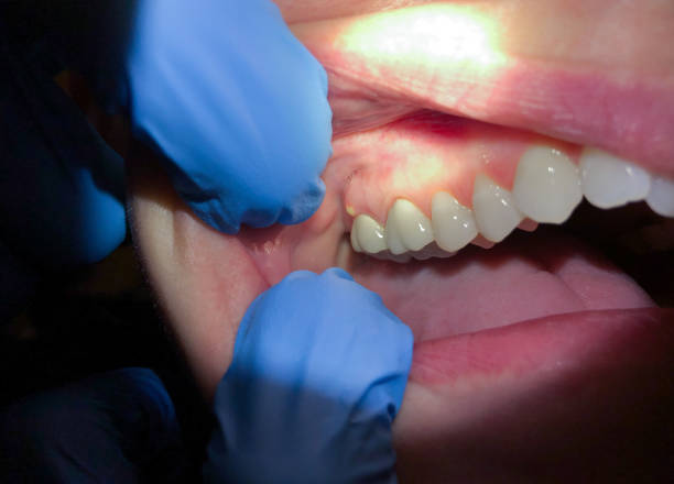 Best Emergency Gum Pain Relief  in Fountainhead Orchard Hills, MD