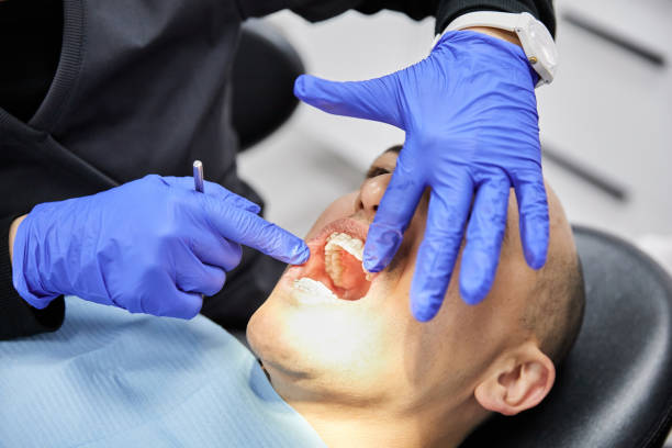 Best Cracked Tooth Emergency Dentist  in Fountainhead Orchard Hills, MD